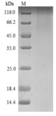 SDS-PAGE (ROBO1-2415M).jpg